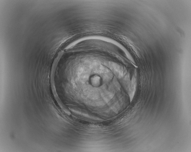 X0000115190596200911181449