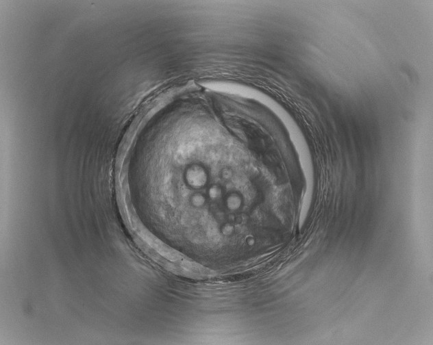 X0000115190600200911181449