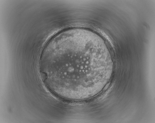 X0000115190625200911181448