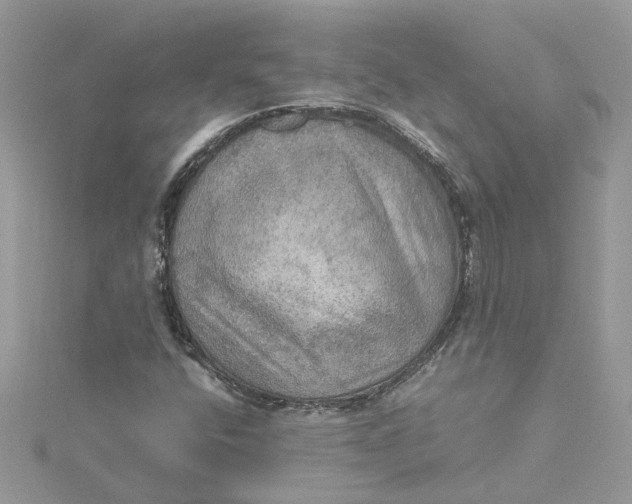 X0000115191400200911181438