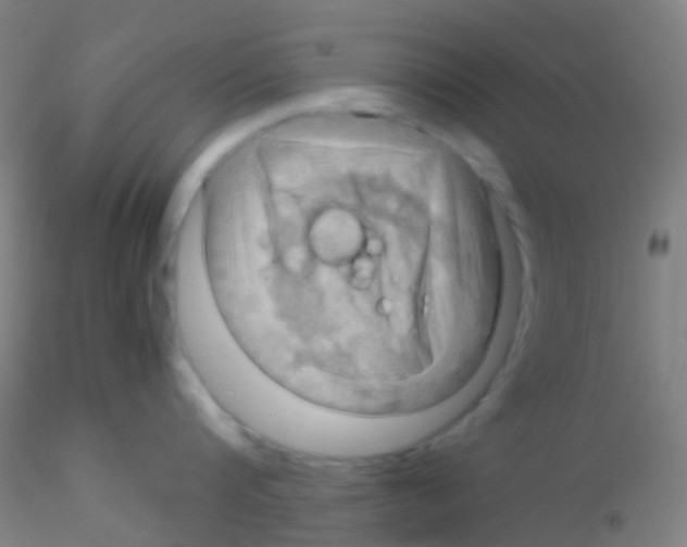 X0000115190816200911251418