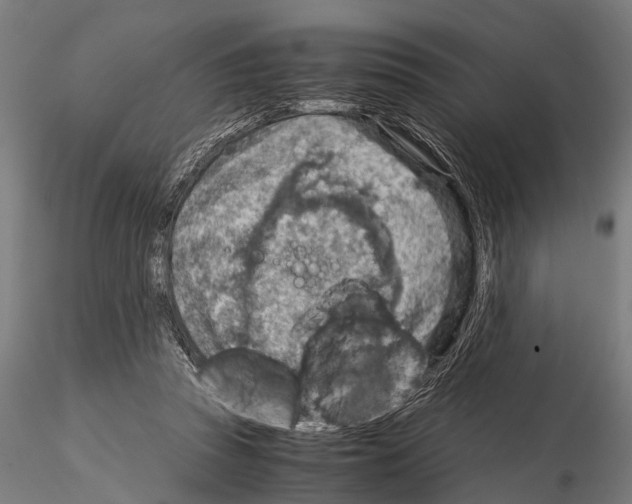 X0000115190353200912091116