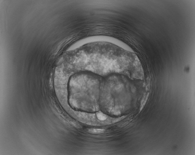 X0000115190361200912091116