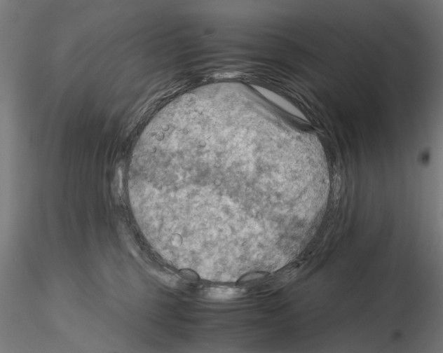 X0000115190375200912091116