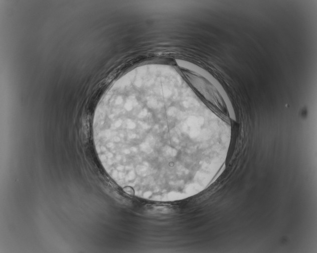 X0000115190475200912091115