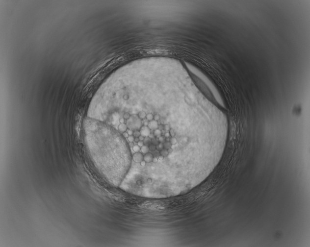 X0000115190648200912091111