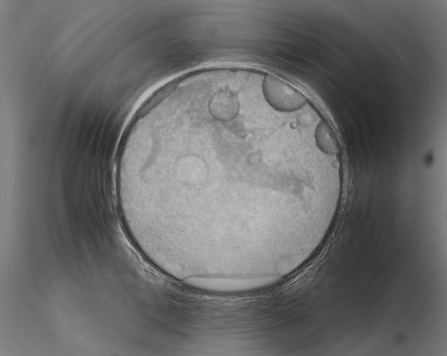 X0000115190996200912091106