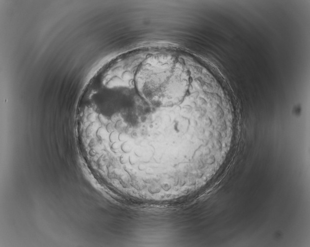 X0000115191038200912091106