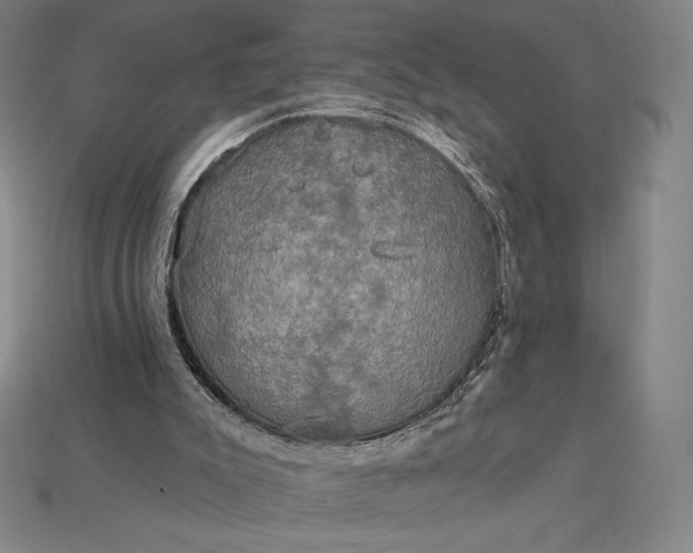 X0000115200007200911121852