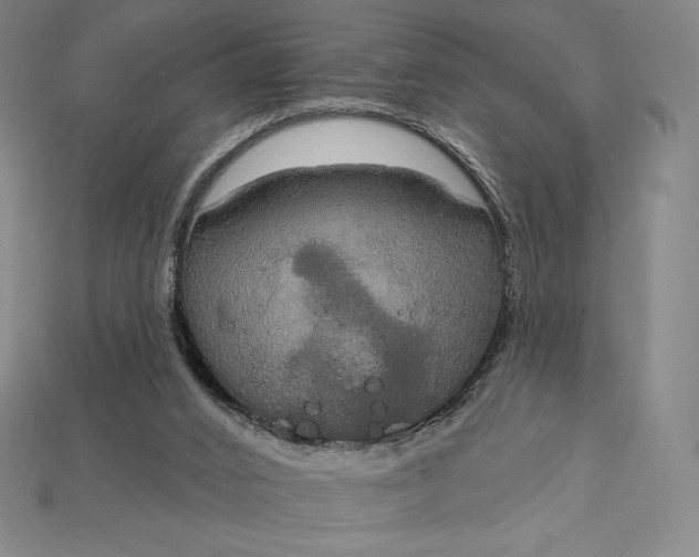 X0000115200016200911121852