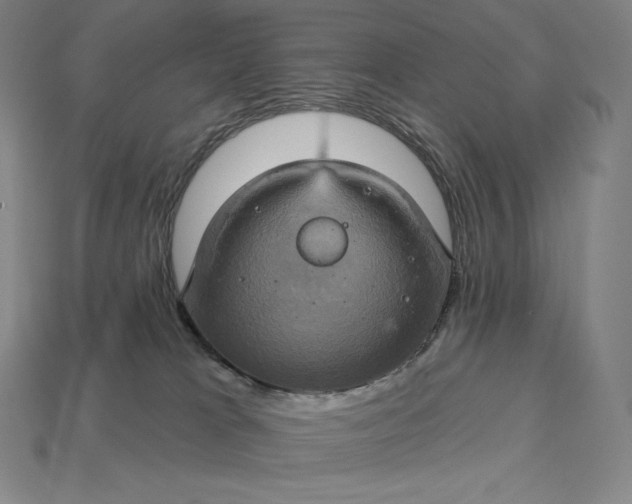 X0000115200037200911121852