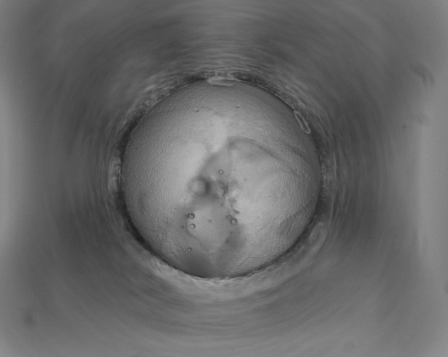 X0000115200038200911121852