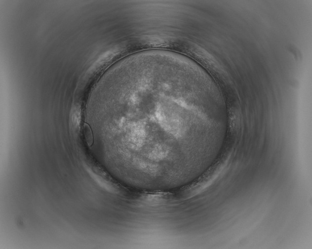 X0000115200072200911121852