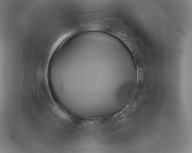 X0000115200147200911121850