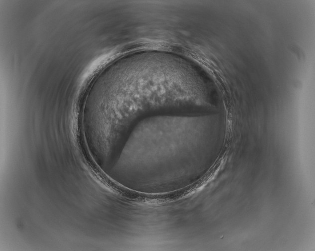 X0000115200149200911121850
