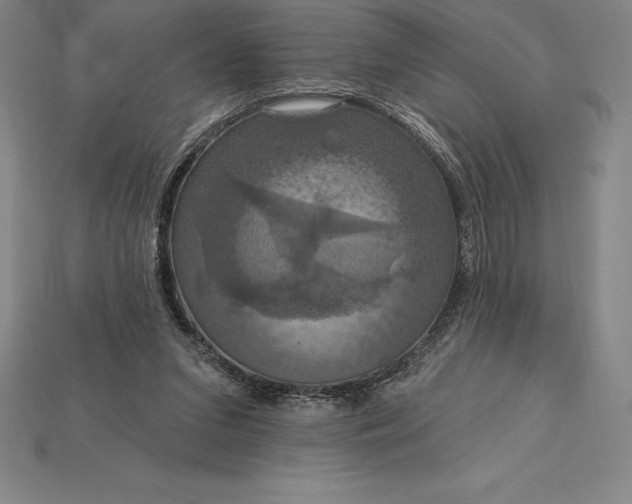 X0000115200207200911121850