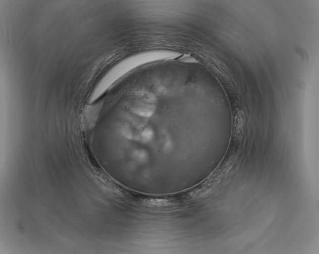 X0000115200361200911121847