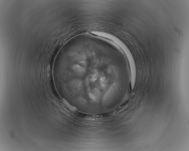 X0000115200563200911121845