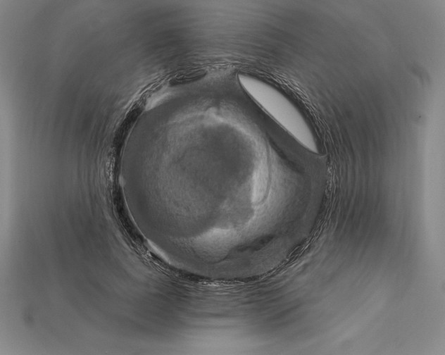X0000115200739200911121841