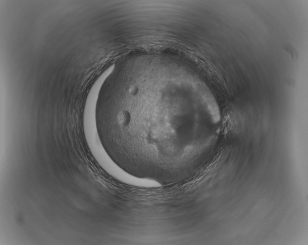 X0000115200772200911121841