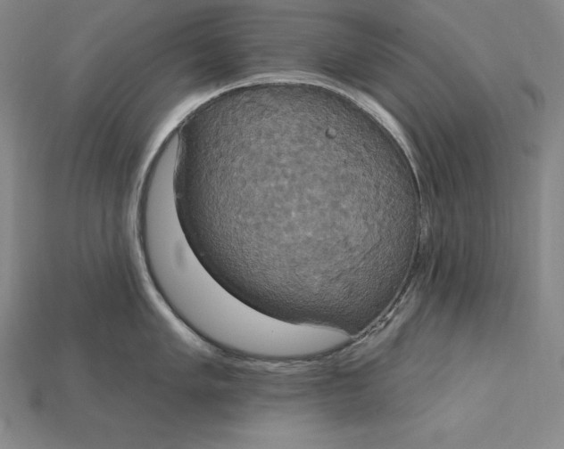X0000115201005200911121838