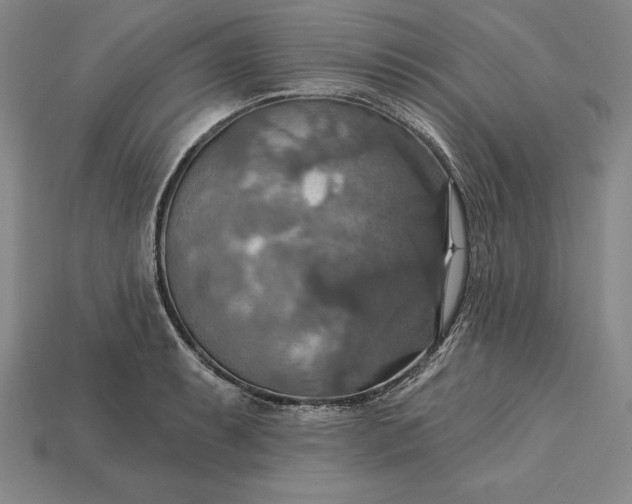 X0000115201087200911121837