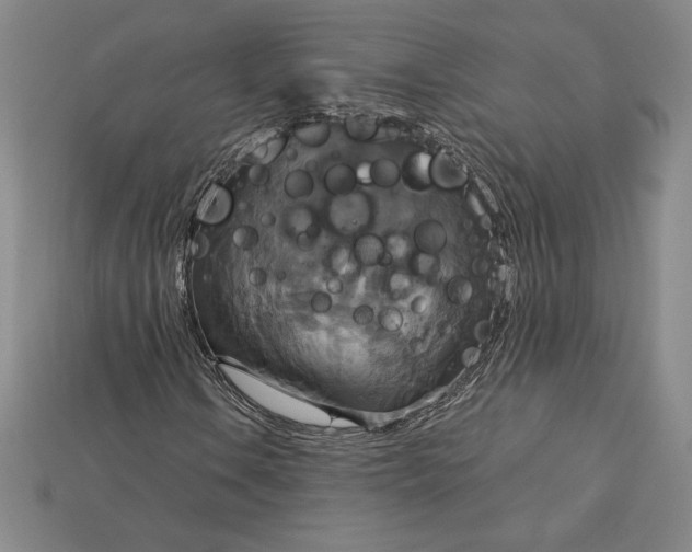 X0000115201106200911121836