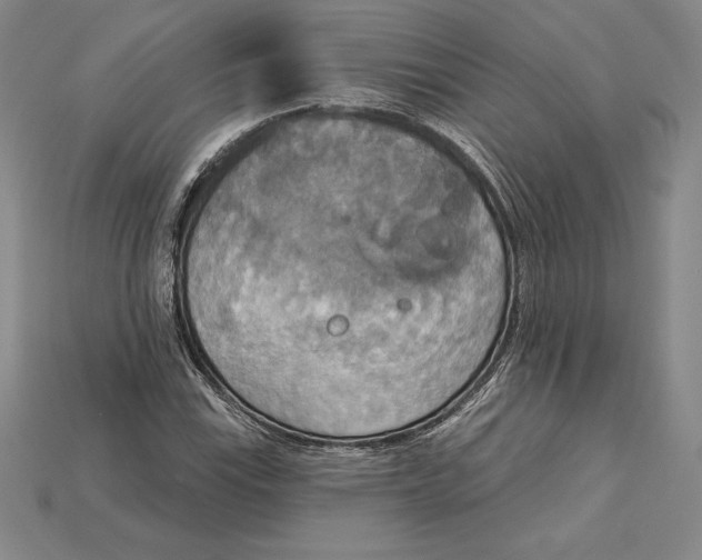 X0000115201115200911121836