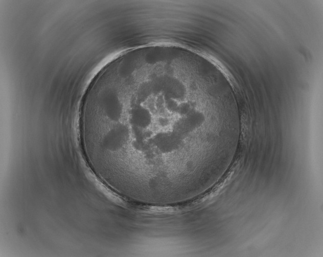 X0000115201142200911121837