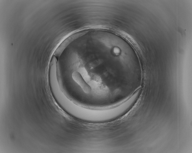 X0000115201236200911121835
