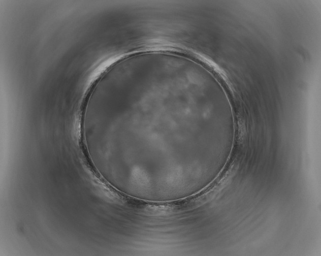 X0000115201415200911121832