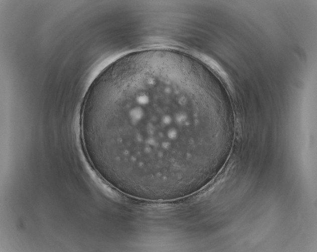 X0000115201431200911121833
