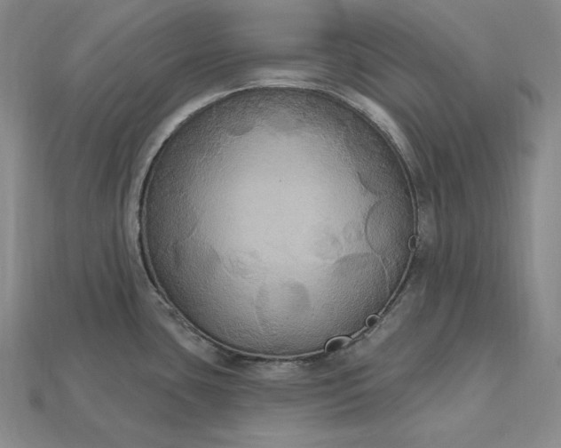 X0000115201435200911121833