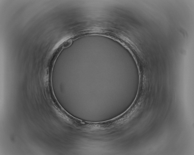 X0000115201450200911121832