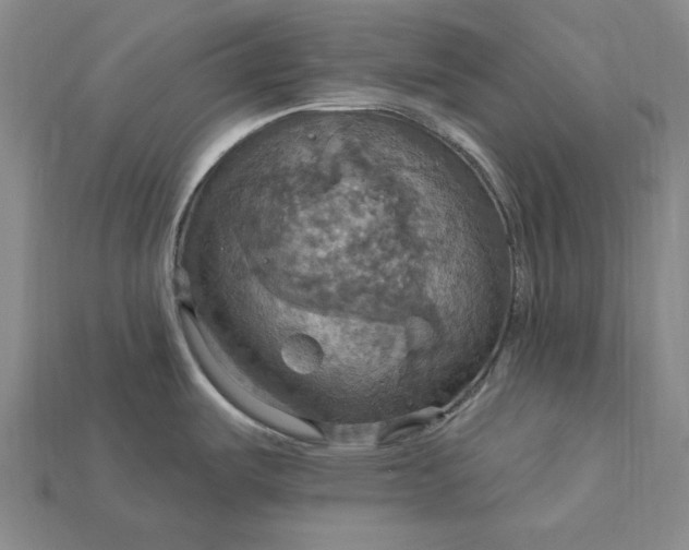 X0000115201487200911121832
