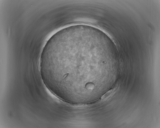X0000115201535200911121832