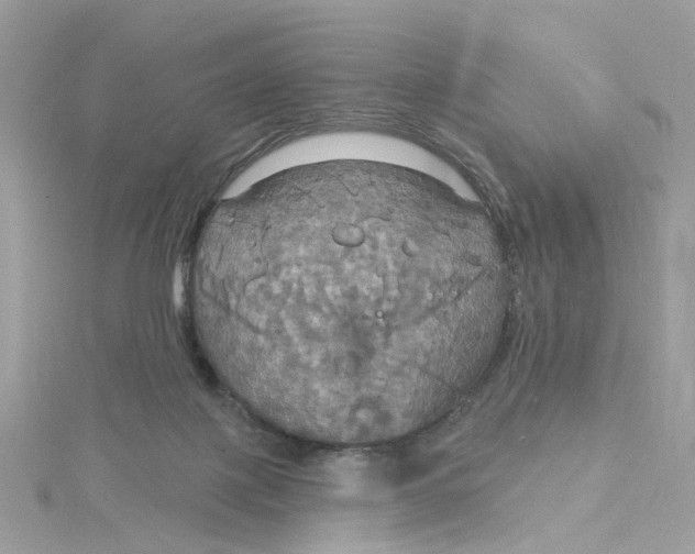X0000115200075200911181516