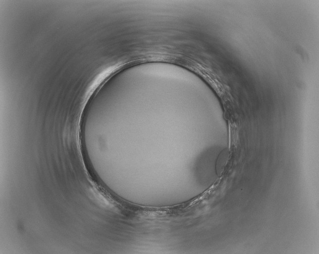 X0000115200147200911181515