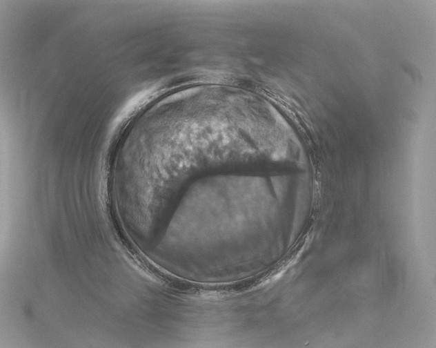 X0000115200149200911181515