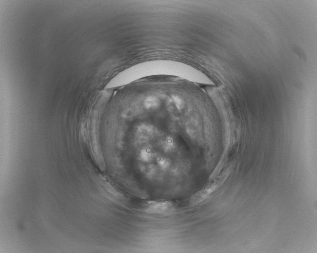 X0000115200185200911181515