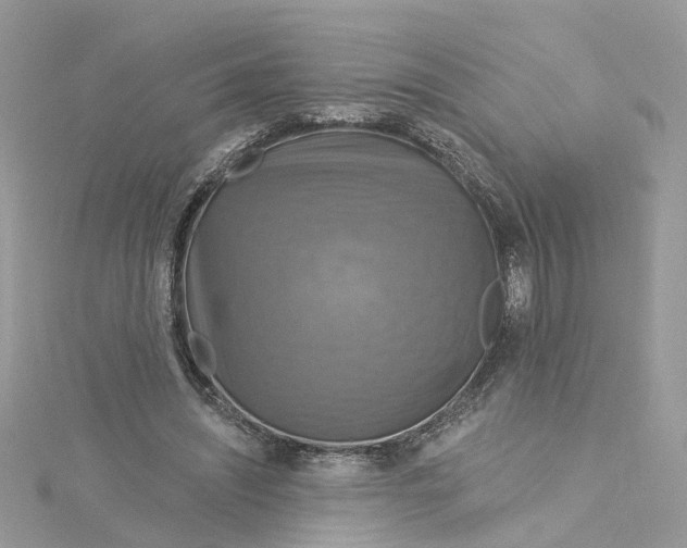X0000115200444200911181511