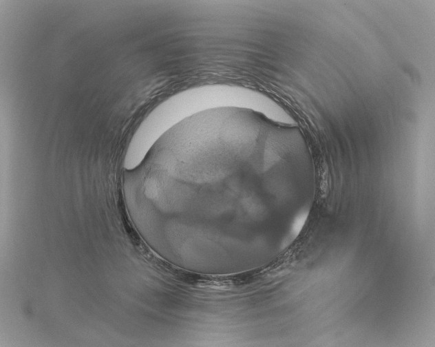 X0000115200559200911181510