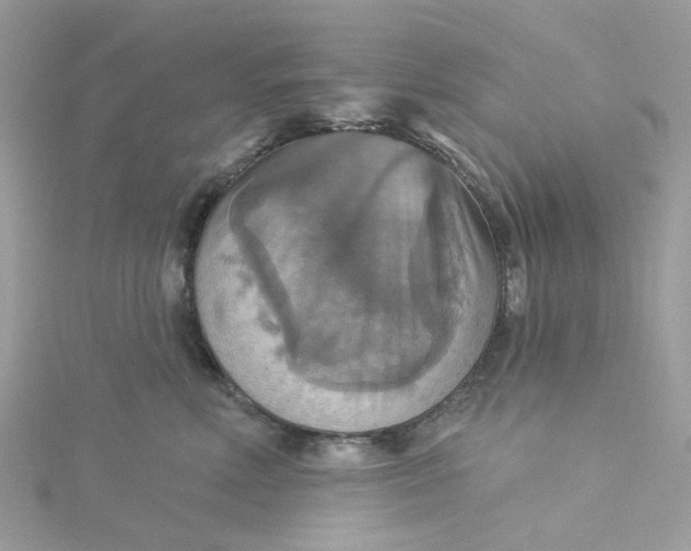 X0000115200618200911181509