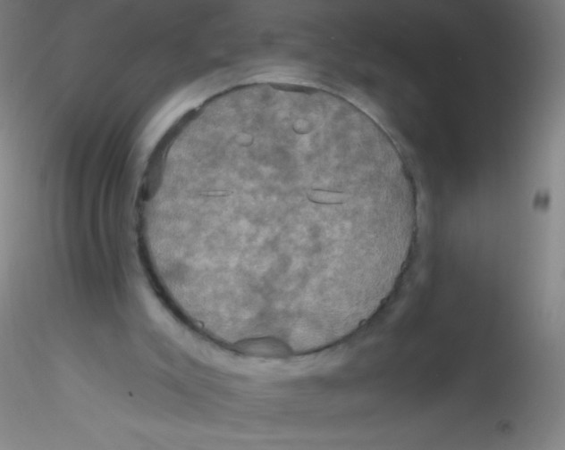 X0000115200007200911251454