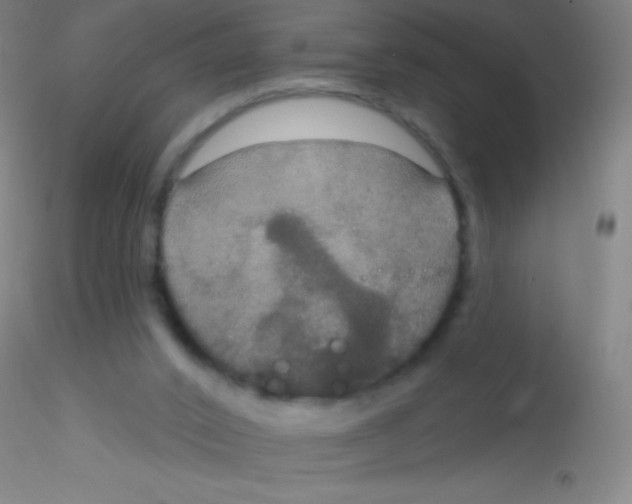 X0000115200016200911251454