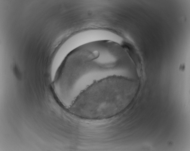 X0000115200019200911251454