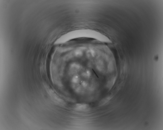 X0000115200185200911251452