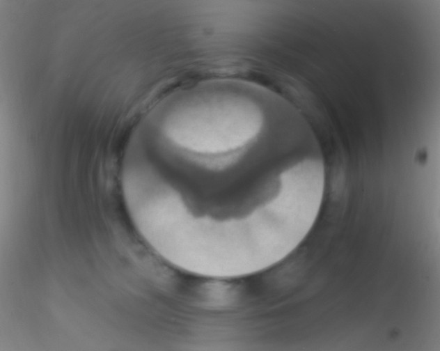X0000115200326200911251449
