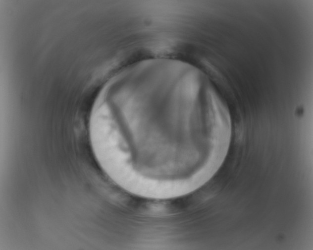 X0000115200618200911251444