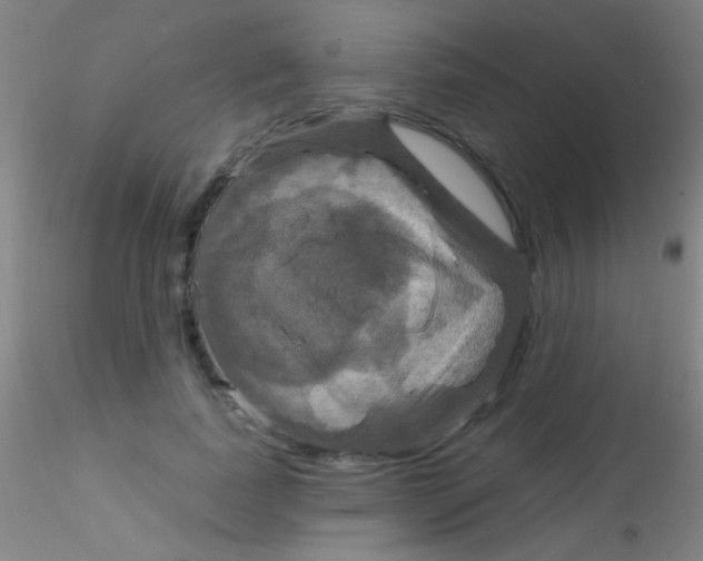 X0000115200739200911251442